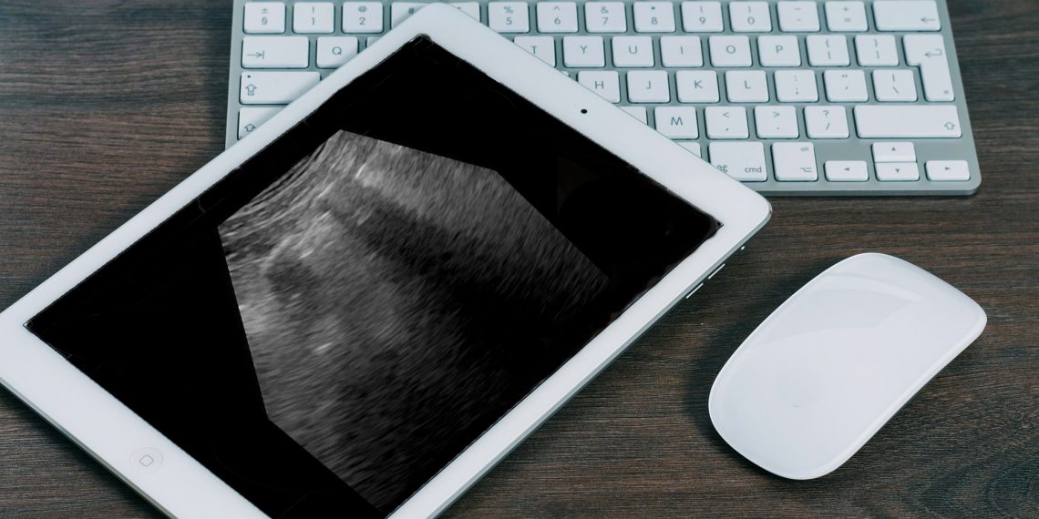 INESC TEC testa o uso de inteligência artificial no diagnóstico da COVID-19