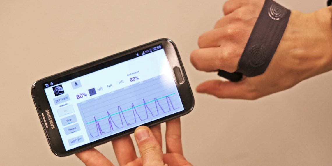 Spin-off INESC TEC recebe investimento de 100 mil euros para expandir ensaios clínicos em pacientes com Parkinson