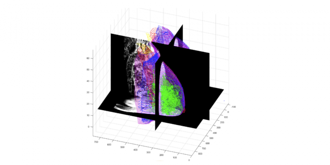 Investigadores estudam criação de atlas virtual de imagens 3D da mama