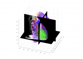 Investigadores estudam criação de atlas virtual de imagens 3D da mama
