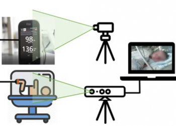 Nova ferramenta deteta sinais vitais de bebés prematuros através de métodos não invasivos