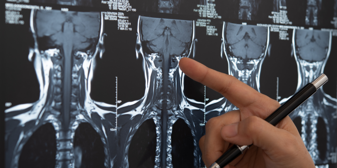 Project involving INESC TEC received the Santa Casa Neurosciences Award