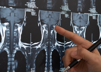 Project involving INESC TEC received the Santa Casa Neurosciences Award