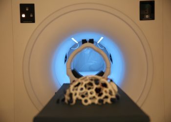 Investigadores testam solução com recurso a Inteligência Artificial para classificação de crises epiléticas em tempo quase-real