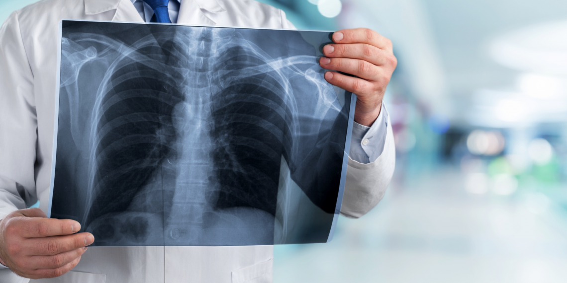 Diagnóstico médico: garantir privacidade e explicar modelos de deep learning são objetivos de projeto liderado pelo INESC TEC