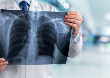 Diagnóstico médico: garantir privacidade e explicar modelos de deep learning são objetivos de projeto liderado pelo INESC TEC