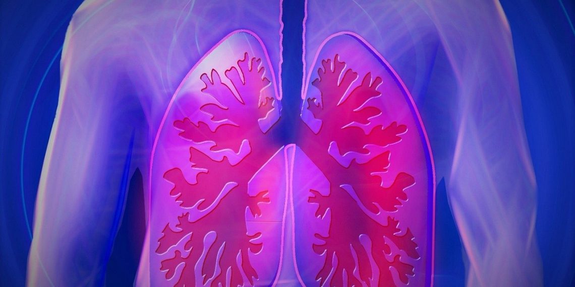INESC TEC leads project to study lung cancer using Artificial Intelligence