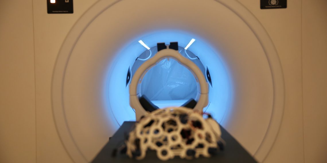 Portugal integra roteiro europeu de neurociência