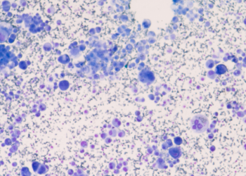 INESC TEC ajuda a treinar algoritmos para aperfeiçoar diagnóstico de doenças como o cancro