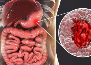 INESC TEC entre especialistas internacionais que lançaram normas para o uso de inteligência artificial no diagnóstico de cancros digestivos