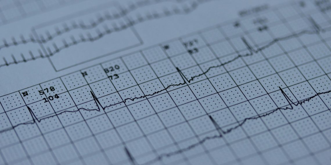INESC TEC quer levar tecnologia de deteção precoce de doenças cardíacas a países em desenvolvimento