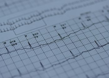INESC TEC quer levar tecnologia de deteção precoce de doenças cardíacas a países em desenvolvimento