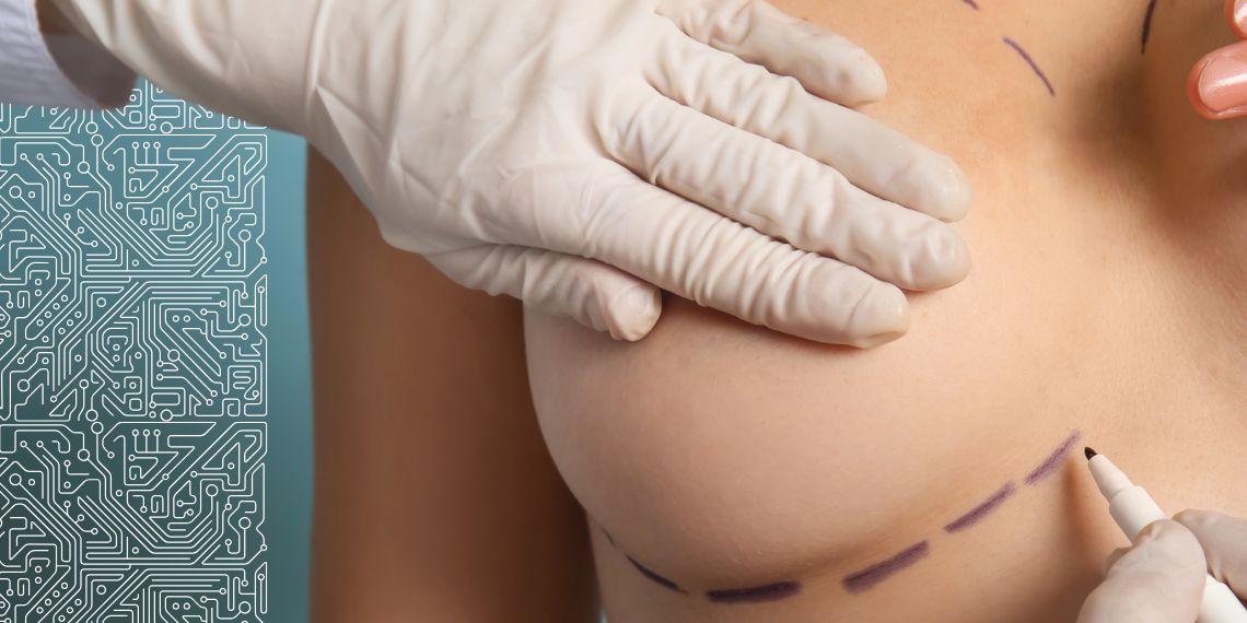 More information, better decisions: Artificial Intelligence that anticipates breast cancer surgery outcomes